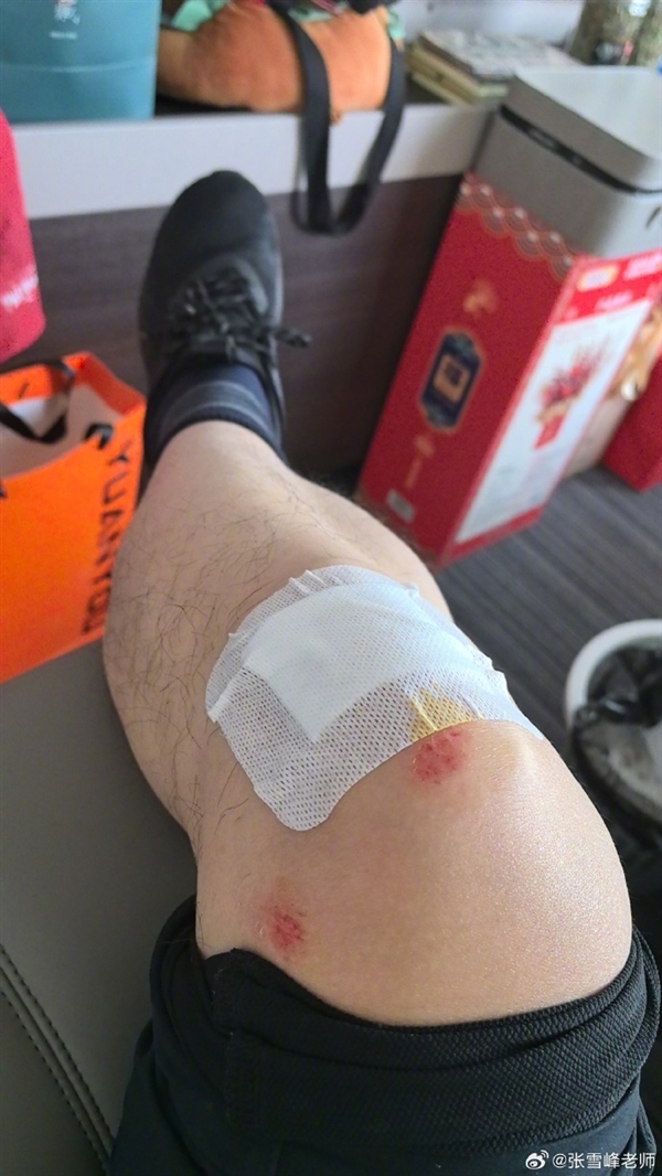 女大学生闯红灯 张雪峰骑电动车急刹摔倒：为保护她只能伤自己